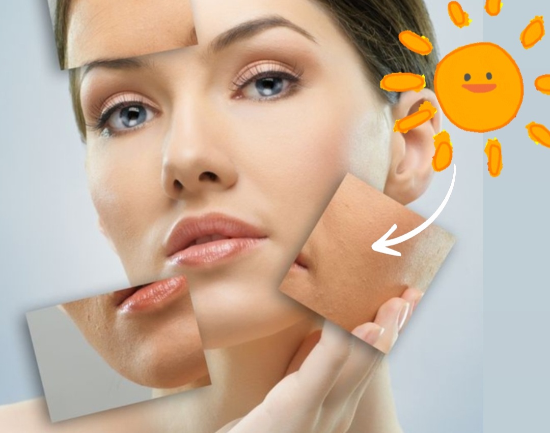 راه‌های مقابله با لک‌های پوستی ناشی از آفتاب‌سوختگی